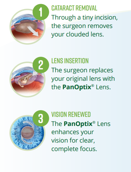PIctures of Cataract Removal 
