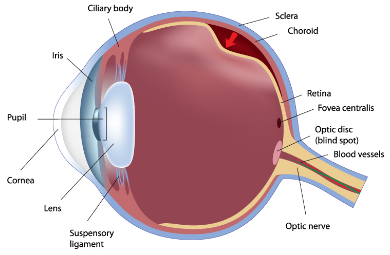 Retinal detachment eye graphic