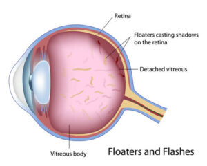 anatomy of flashes 