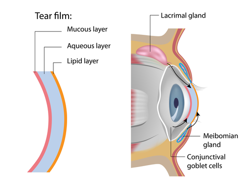 Diagram of dry eye 