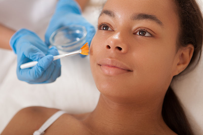 Close up of a woman smiling while beautician applies liquid peeling on her face